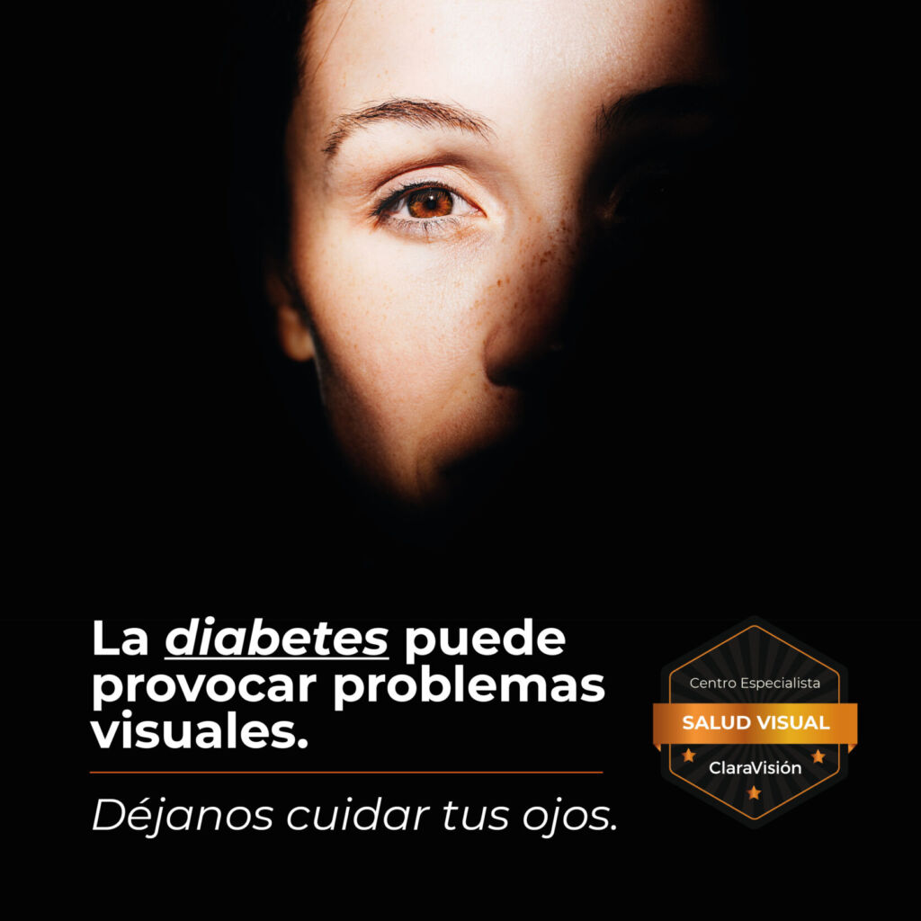 La diabetes puede provocar problemas de visión.